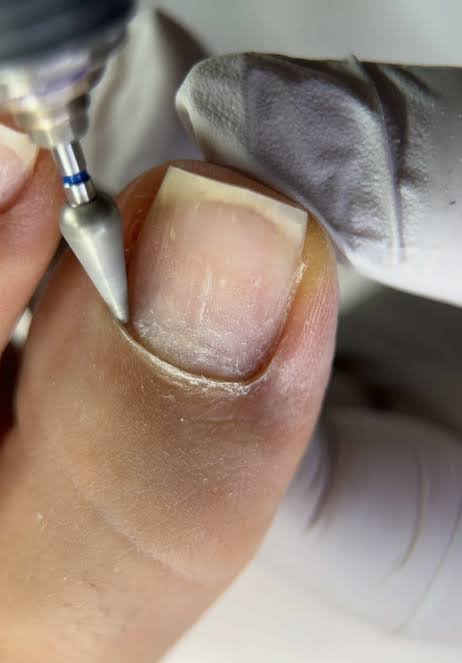 Cuidado experto de uñas y cutícula